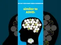 What is AD Brains on