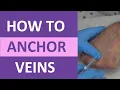 How to Anchor Veins Venipuncture IV Therapy Blood Draw Phlebotomy Rolling Veins