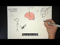 What is Brain Computer Interface and how can it help stroke patients recover mobility