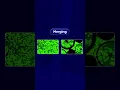 Blob Detection