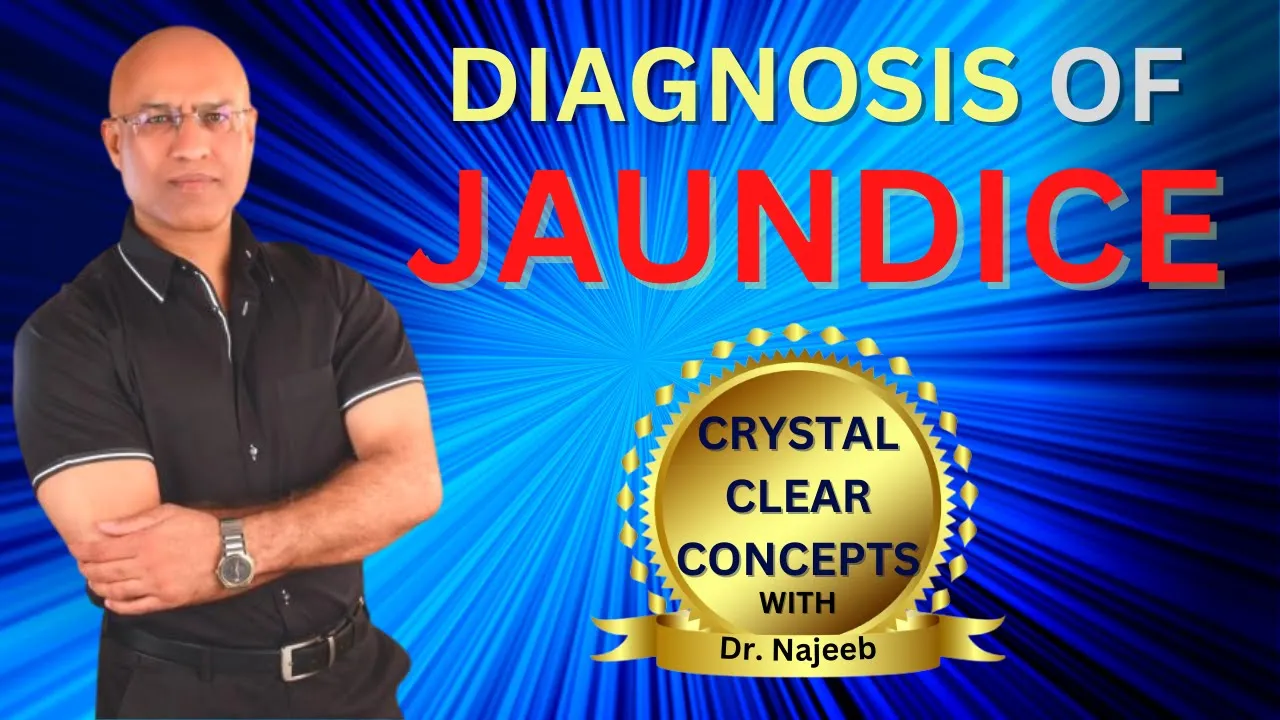 Diagnosis Of Jaundice Under Different Conditions | Dr Najeeb Lectures
