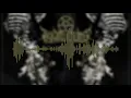 Thy Art Is Murder - Killing Season (Audio Visualizer)