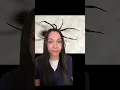 Common Spider Bites Part 1