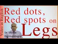 Red on legs