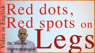 Red on legs