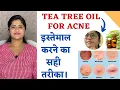 Tea Tree Oil for Acne Correct way to use How to use tea tree oil