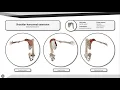 Shoulder horizontal extension