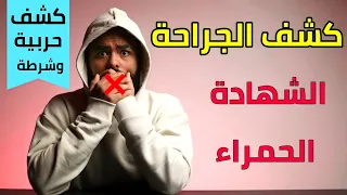 حقيقة   كشف الجراحة   و الشاهدة الحمراء و الكشف بيتم إزاي  دندنها