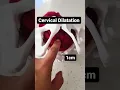 Download Lagu How the cervix dilated. Cervical dilation in 20 seconds