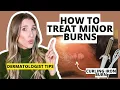Download Lagu Dermatologist Explains How to Treat Minor Burns \u0026 Minimize Scarring | Dr. Sam Ellis