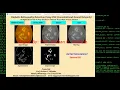 Diabetic Retinopathy Detection Using CNN Source Code Python OpenCV Tensorflow Project Code