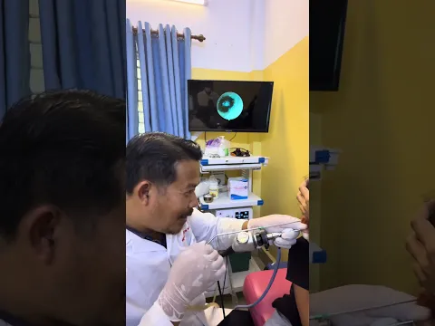 👀 Wait for the Final Piece of This Earwax Removal! #earcleaning #ent #shorts