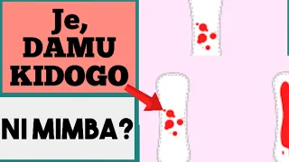 Je DAMU Kidogo Ni Dalili Za Mimba Mimbachanga 