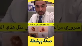 كيف نفرق بين الشامة الحميدة والخبيثة د  انور الحمادي دندنها