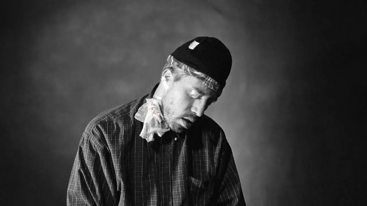 Soft White Underbelly - Bubonic Plague Update 2025 (Deleted original)