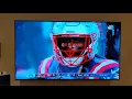 Xfinity picture quality problems