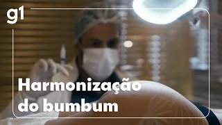 Dermatologista explica riscos da  harmonização do bumbum #bemestar
