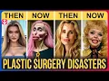 Download Lagu 50 Celebrity Plastic Surgery Disasters | You’d Never Recognize Today