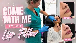 I GOT LIP FILLER Come With Me Before After