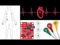 ECG Monitoring with AD8232 ECG Sensor and Arduino