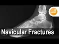 Download Lagu Navicular Fractures with Dr. Erik Nilssen