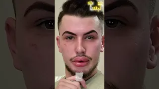 أسوء 3 عمليات تجميل في العالم 