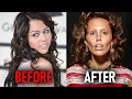 Celebrities Who COMPLETELY RUINED Their Faces With Veneers