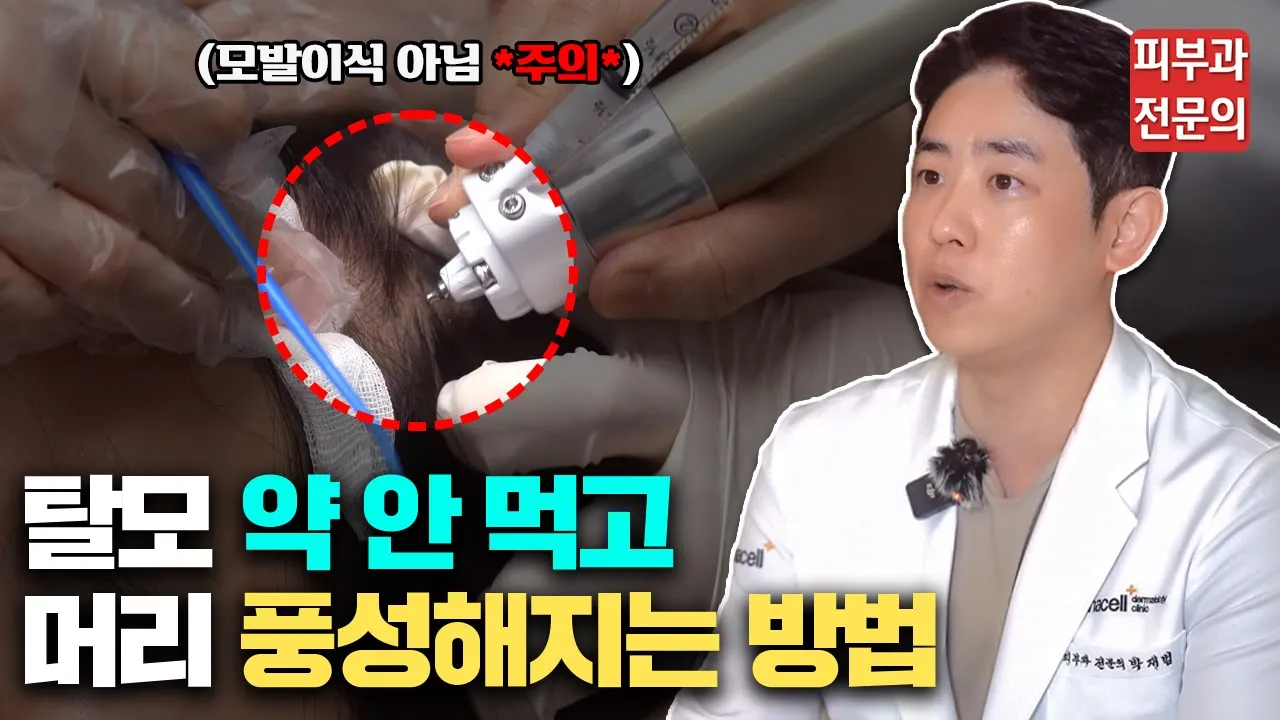 탈모치료 먹는 약 말고 이렇게 치료해 보세요