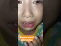 Download Lagu Bibir nya Jontor Di Gigit Semut #shorts #nangis