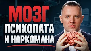 Психопат мыслит совершенно ИНАЧЕ. Он абсолютно здоров!