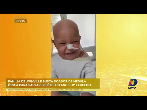 Família de Joinville busca doador de medula óssea para salvar bebê de um ano com leucemia