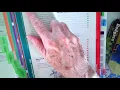 Introduction to Surgery Coding in CPT