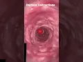 How To CAPSULE Metabolize in Stomach