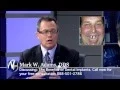 Dental Implants with Mark Adams DDS Clear Choice Dental Implants Centers