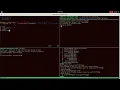 stack overflow shellcode injection