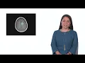 Understanding Multiple Sclerosis The MS Process