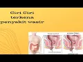 Download Lagu Ciri Ciri terkena penyakit wasir
