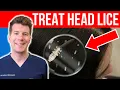 How to TREAT HEAD LICE AND NITS Doctor s step-by-step guide