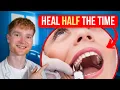 HEAL FASTER After a Tooth Extraction Without Pain