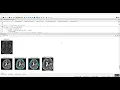 Brain Tumor Segmentation Using Simple CNN Console in Python Projects