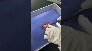 لاب اليوم تشريح الكلية Kidney Dissection كان حلو استمتعنا طالبة طب مختبرات يوميات تشريح 