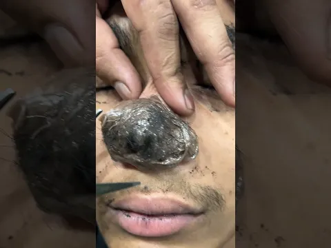 Nose Mask #MensGrooming #BarberShop #Satisfying #Hairline #Waxing