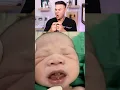 Download Lagu This Baby Was Born With TEETH! 😮🦷 MP3