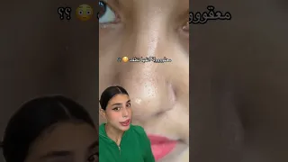 تنظيف الانف من الرؤوس السوداء من اووول مرررا رؤوس سوداء تنظيف البشره خلطات ماسكات بشره 