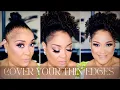 How To Cover Your Bald Thin Edges Traction Alopecia