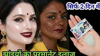 Skin Whitening From First Use! Face Wash Removes Dark Spots in 10 Minutes Permanently