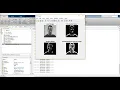 EIGENFACE AND SUPPORT VECTOR MACHINE METHODS BASED MULTI-VIEW FACE DETECTION