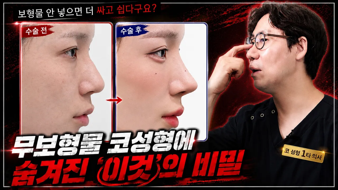 보형물 안 넣으면 더 싸고 쉽다고요?! 무보형물 코성형에 숨겨진 '이것'의 비밀!