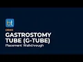 Gastrostomy Tube Placement G-Tube by Interventional Radiology BackTable Demo
