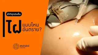  การใช้กรดหรือการกดไฝที่ตลาดนัดมีความเสี่ยงอย่างไร 